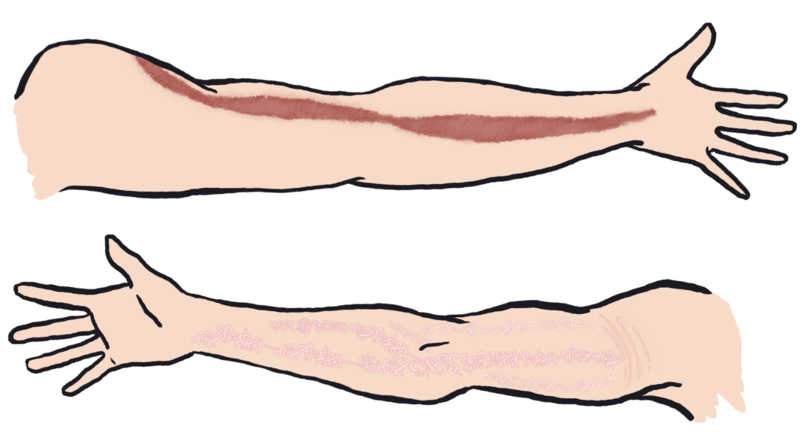 File:Raen arm-detail.PNG